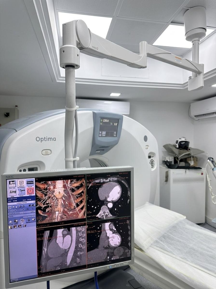 Scanner CT